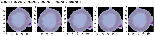 Sample augmented images Sample augmented images